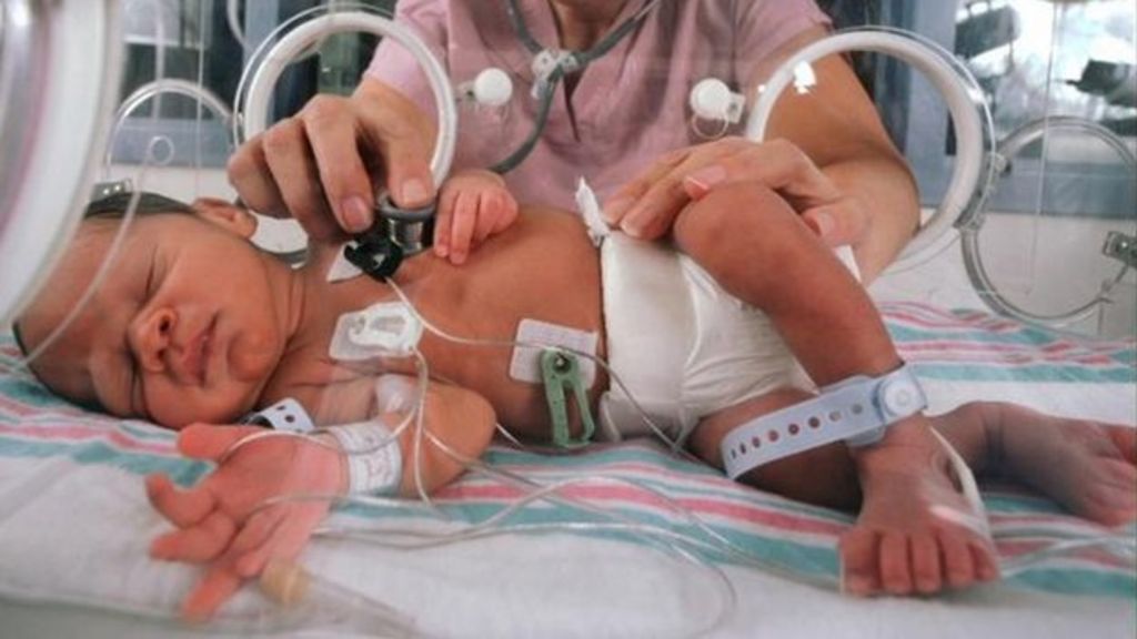 warning-over-plastics-used-in-treating-premature-babies-bbc-news