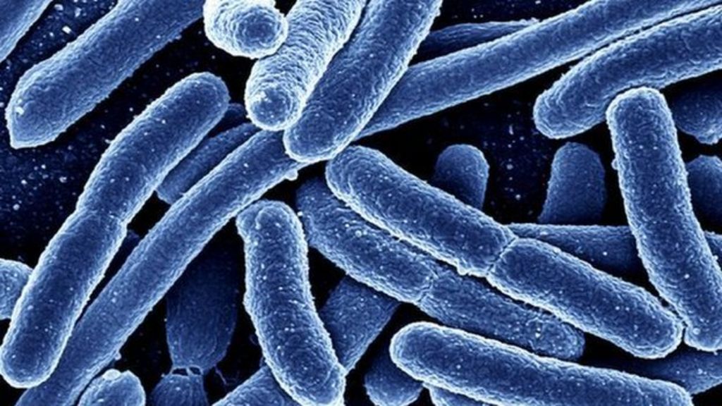 Superbugs to kill 'more than cancer' by 2050 BBC News
