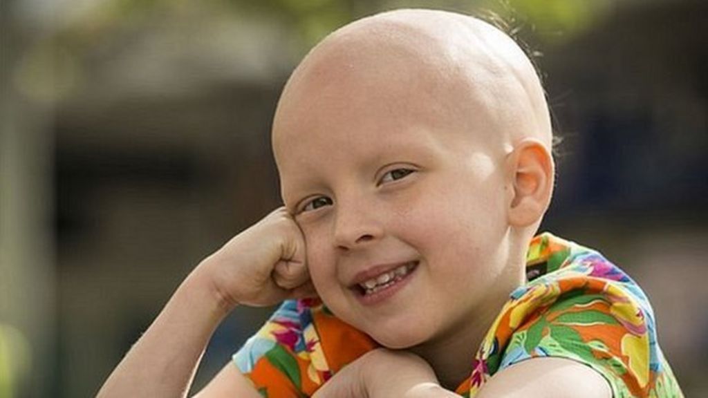 Alopecia Girl Sydney Caraher Wins Modelling Contract Bbc News 