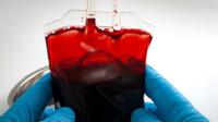 Hands holding a bag of blood