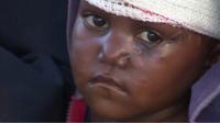 Child in DRC