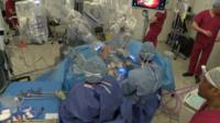Robotic surgery