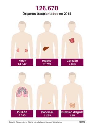 Ilustración de trasplantes de órganos en el mundo en 2015