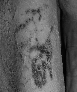 Imagen del tatuaje de la momia varón.