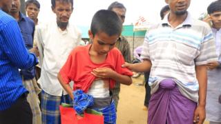 An injured Rohingya boy lifts his T-shirt to reveal a large bandage across his stomach
