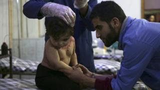 An injured child in a field hospital in Damascus in November, 2015