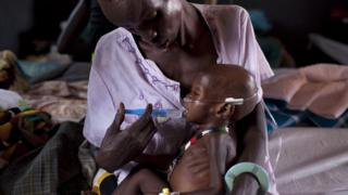 Près de 250 enfants de plus de cinq ans sont morts au Soudan des suites de diarrhée aigüe.