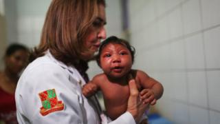Doctora con un niño con microcefalia.