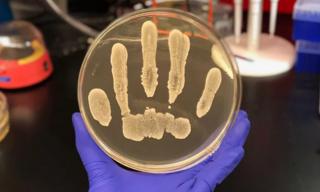แบคทีเรีย Staphylococcus epidermidis ที่เติบโตในจานเพาะเชื้อ