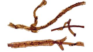 Filaments of the ancient fungus