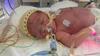 Ryan Quinn in St Mary's Hospital