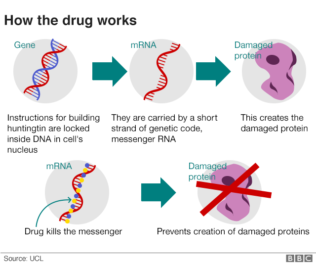 Huntingtons breakthrough may stop disease