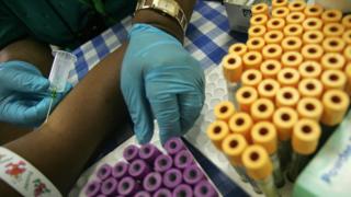 Nurse wey dey do HIV test for Patient