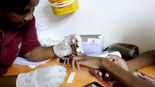 Afrika y'epfo ifise miliyoni 7 z'abanduye umugera wa SIDA