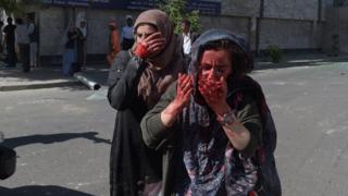 Mujeres con las manos ensangrentadas tras la explosión en el distrito diplomático de Kabul, Afganistán, el 31 de mayo.