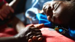 Kugabanirizwa ububabare ni ngombwa ku wuri ku mpfiro