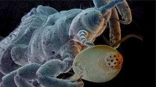 Lice