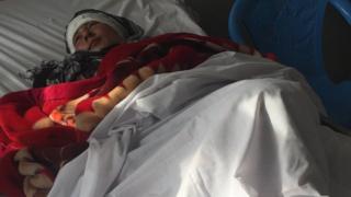 Zarina recovering in hospital (01 February 2017)
