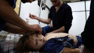 Child being treated in Syrian hospital