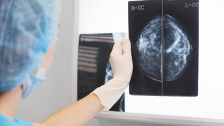 'One-stop shops' for cancer diagnosis 36