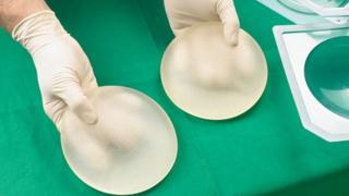 Breast implants