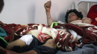 An injured man is treated at a hospital in Hassakeh, Syria (2 May 2017)