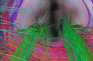 Brain Scan
