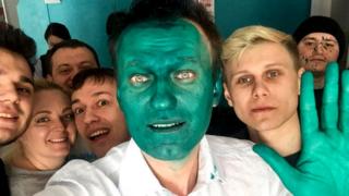 Алексей Навальный со сторонниками - после инцидента с зеленкой