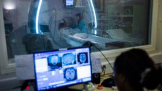 MRI