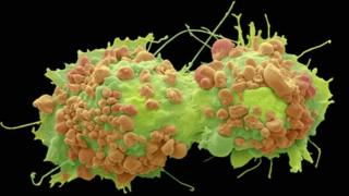 cancer cells