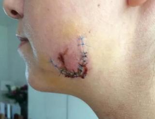 Injured woman