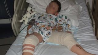 Shot seven-year-old