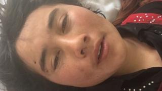 Zarina'nın sağlık durumu yerinde olsa da travma geçirdiği için hastanede tedavi görüyor.
