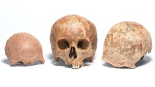Roman skulls uncovered at Liverpool Street