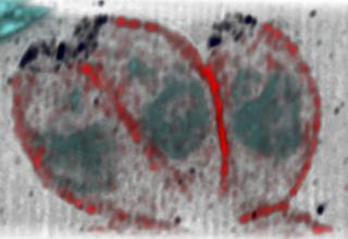 Toxoplasmosis-causing parasites - Leandro Lemgruber, University of Glasgow