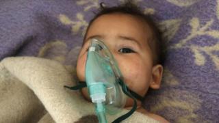 シリア北西部イドリブ県で化学兵器の使用が疑われる爆撃があった。多くの子供も被害に遭ったという(4日)。