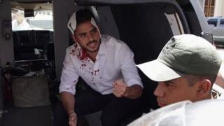 Armando Armas con vendas en la cabeza