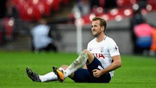 Mkufunzi wa Tottenham amesema kuwa anaweza kuishinda Manchester United bila ya mshambuliaji Harry Kane anayeuguza jeraha,