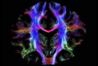 Wiring the human brain - Alfred Anwander, Max Planck Institute for Human Cognitive and Brain Sciences