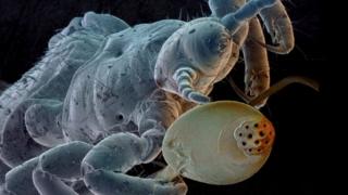 Head louse. Coloured Scanning Electron Micrograph (SEM) of a human head louse Pediculus humanus capitis, with an egg. The louse is clinging to a human hair.