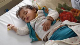 Heba, una niña de un año, recibe el tratamiento contra el cólera en un centro de Saná, Yemen, el 10 de junio de 2017.
