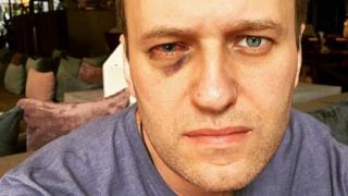 Navalny photo on Instagram