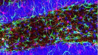Microglia are immune cells present in the brain