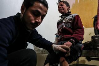 A boy receives treatment following a reported government air strike in Douma, in the rebel-held Eastern Ghouta, Syria (20 February 2018)
