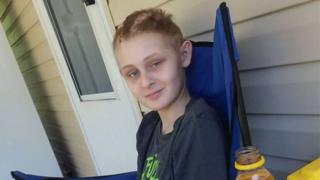Trenton McKinley, the 13-year-old involved in the accident