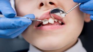 Child having teeth inspected