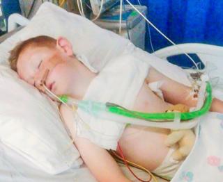 Cameron Dickson, nine, was treated in intensive care