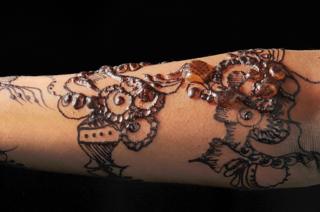 Black henna allergy - Nicola Kelley, Cardiff and Vale University Hospital NHS Trust