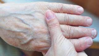 A hand showing prominent veins