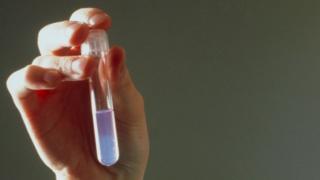 Woman holds a semen sample during analysis before its use in artificial insemination.